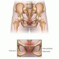 Ευστράτιος Γ. Καβρουδάκης MD, MSc,Χειρουργός, Ορθοπαιδικός, Τραυματιολόγος