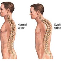 Ευστράτιος Γ. Καβρουδάκης MD, MSc,Χειρουργός, Ορθοπαιδικός, Τραυματιολόγος