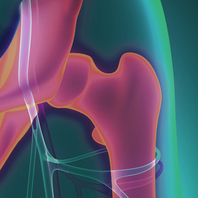 Ευστράτιος Γ. Καβρουδάκης MD, MSc,Χειρουργός, Ορθοπαιδικός, Τραυματιολόγος